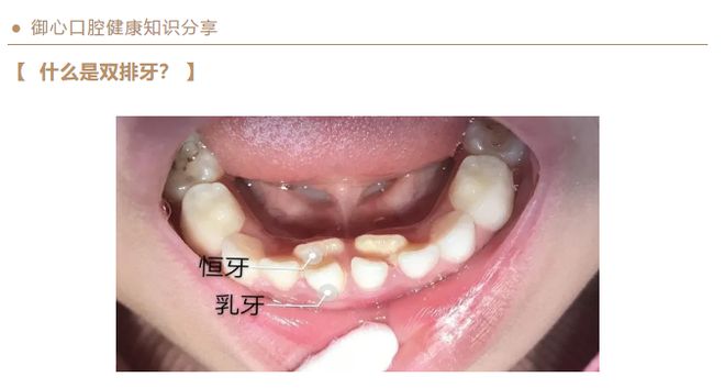 cad中粗线条怎么改成细的_cad线条粗细怎么改_cad改变线条粗细度